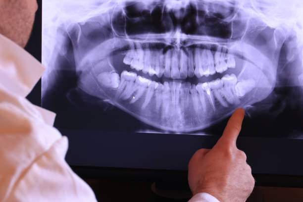 Best Emergency Gum Treatment in Deerwood, TX