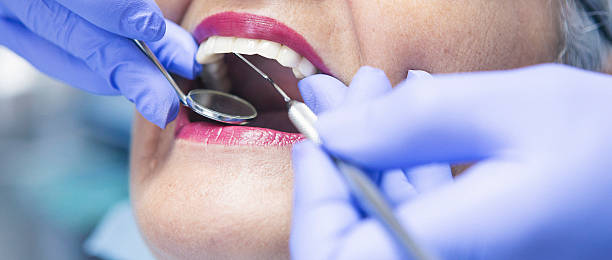 Best Emergency Tooth Extraction in Deerwood, TX
